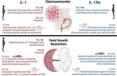 The role of interleukin-1 in perinatal inflammation and its impact on transitional circulation